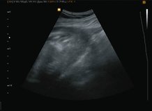 ultrasonography of the small baby. Video full hd.