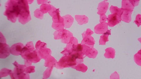 Multiple squamous epithelium under the microscope - Abstract pink dots on white background.