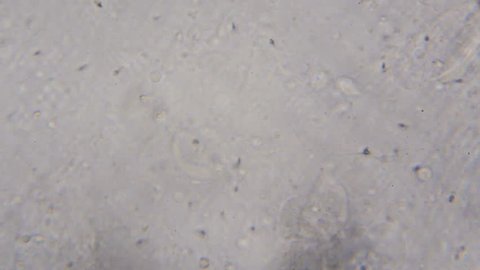 Live human sperm (spermatozoa motion) under microscope.