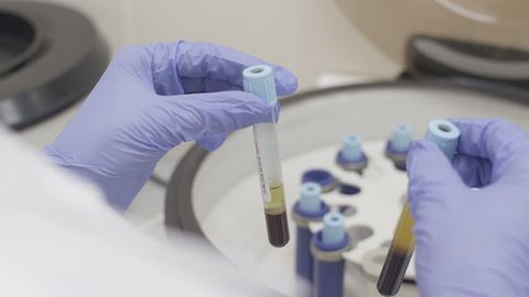 laboratory analysis of blood