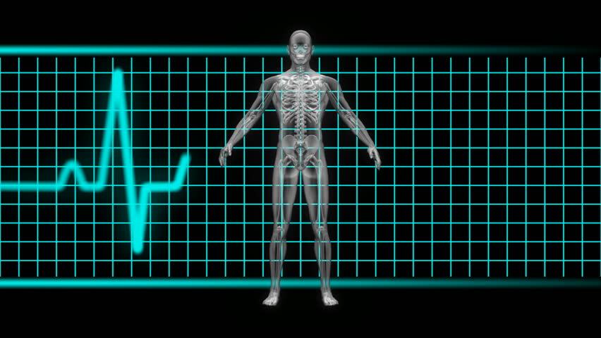 X-ray of man in blue with EKG in background. Loopable. HD 1080
