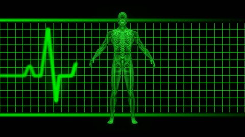 X-ray of man in green with EKG in background. Loopable. HD 1080