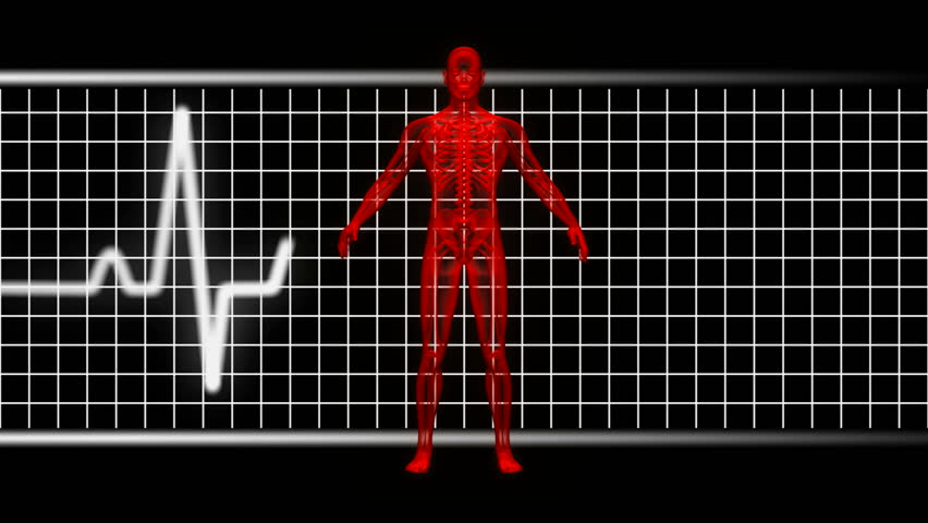 X-ray of man in red with EKG in background. Loopable. HD 1080