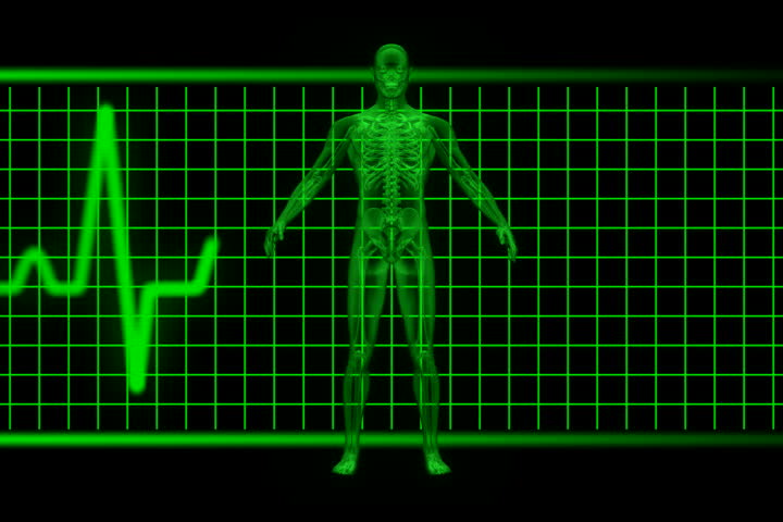 X-ray of man rotating with EKG in background green. Loopable.