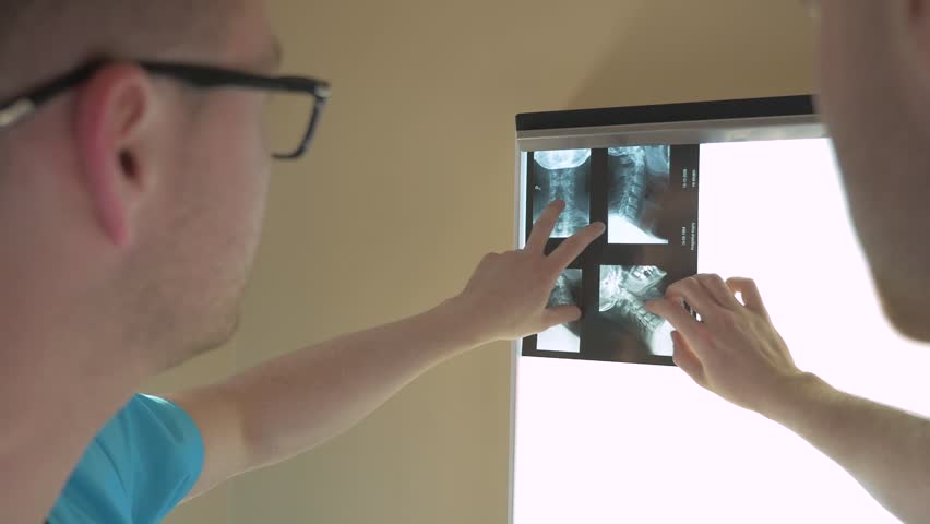 Two doctors are looking at their patient x-ray. They are talking | Shutterstock HD Video #16527649