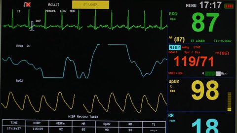 Ekg Respiration Oxygen Saturation Numbers の動画素材 ロイヤリティフリー Shutterstock