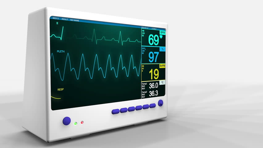 machine used to monitor heartbeat