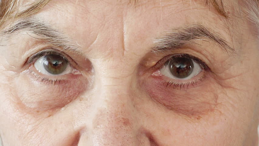 Vision Concerns Associated With Aging