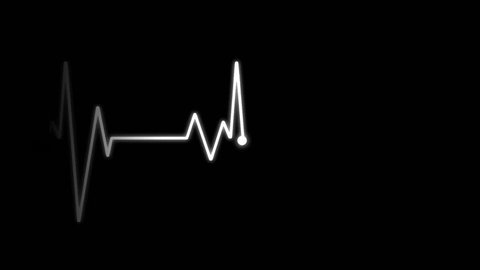 EKG Electrocardiogram - Alpha only