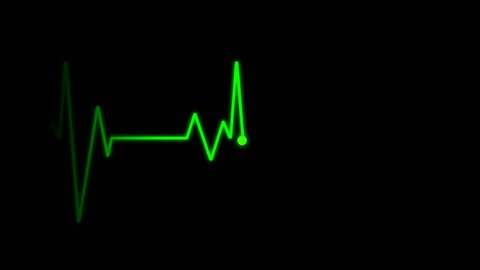 EKG Cardiogram monitor