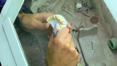 Dental technician grinding imprint of false teeth for dental prosthesis with a grinder