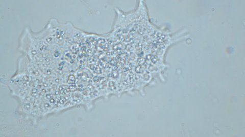 Amoeba under microscope