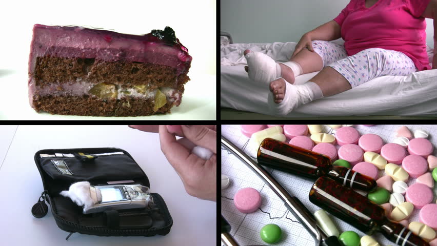 Obesity and diabetes