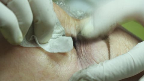Old woman lies and getting eyelash makeup at beauty salon. Applying Permanent Make up on eyelash. Hands of beautician are preparing the skin for the procedure or cleaning
after the procedure
