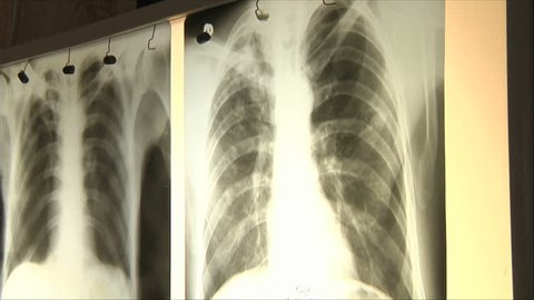 doctors regard chest x-ray 2