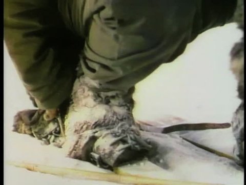 Close-up of hand taking off fur glove to reveal frostbite