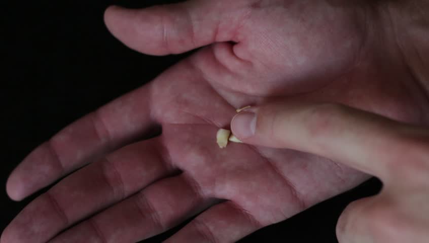 Child milk teeth in man