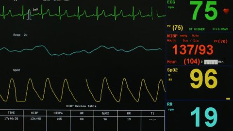 EKG, respiration, oxygen saturation numbers on vital signs monitor decline, while colorful, electrical waves change patterns, alerting medical staff of patient health crisis.