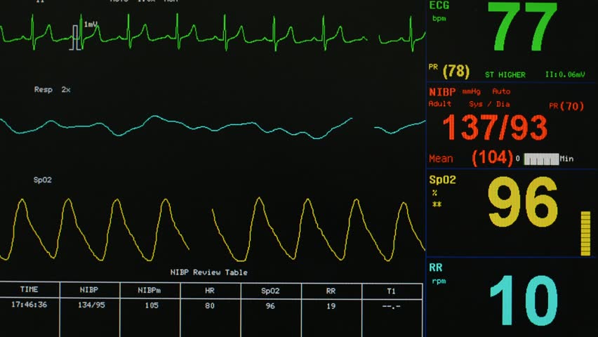 Vital signs monitor
