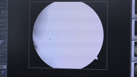 Modern automated machine examining eyeball. Eye examination test on a professional medical equipment screen.