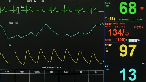 EKG monitor in ICU