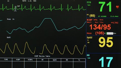 Ekg Respiration Oxygen Saturation Numbers の動画素材 ロイヤリティフリー Shutterstock