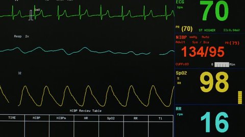 EKG monitor in ICU unit show The waves of blood pressure, blood oxygen saturation, ECG,heart rate