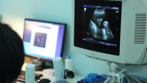 
ultrasound in pregnancy, screen with the image of the child in the womb
