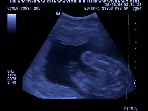In the Utero an Infant Stock Footage Video (100% Royalty-free) 9228377 | Shutterstock In the Utero an Infant Stock Footage Video (100% Royalty-free) 9228377 | Shutterstock