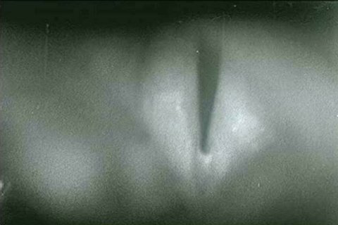 Vocal cords are shown, with black and white film, exhibiting sphincteric action in 1958. (1950s)