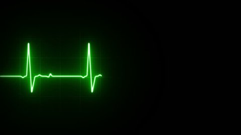 EKG Heart Line Footage Loop