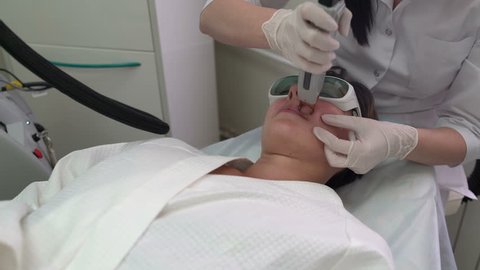 Upper lip hair removal laser by hands of cosmetologist