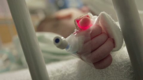 Baby hand in intensive care hospital bed after PDA heart surgery video. Monitor on chest to watch for problems and to ensure recovery. Equipment attached to skin.