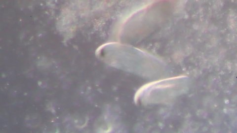 Paramecium caudatum moving in drop of water under the microscopic view