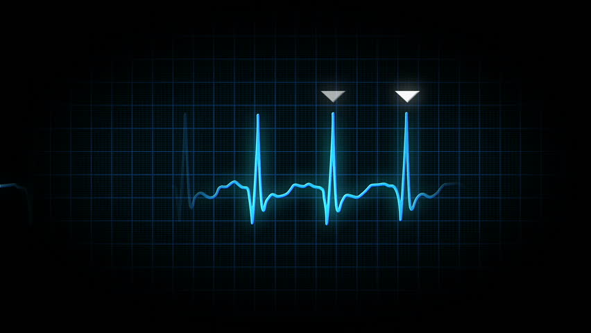 An animated heart monitor EKG line.  Loopable.  With luma matte.