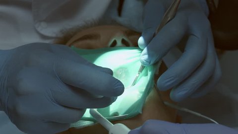 Process of treatment and sealing the tooth 