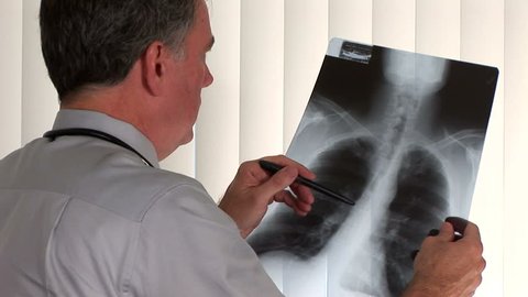 Doctor examines an x-ray