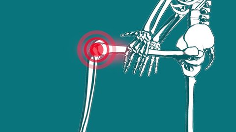 skeleton knee pain animation, 3D render