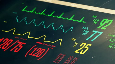 Patient's clinical death and reviving, vital signs rising on bedside ICU monitor. Medical ICU monitor with patient's vital signs