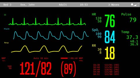 Monitoring of patient's condition, vital signs on ICU monitor in hospital. Medical ICU monitor with patient's vital signs