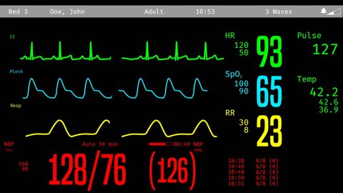 Patient's revival after clinical death, vital signs rising on ICU monitor. Medical ICU monitor with patient's vital signs