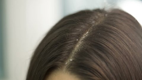 Woman scratching hair on a head with dandruff