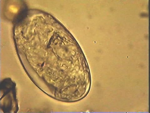 A rotifer actively prepares to break out of its protective cyst (egg).