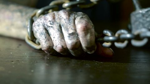 Women's fingers with dirty fingernails and burned skin. female hand shackled.