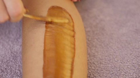 手で蚊に刺されて肌にかゆい赤いこぶを引っ掻く 4k 接写 スローモーション撮影 ステディカム の動画素材 ロイヤリティフリー Shutterstock