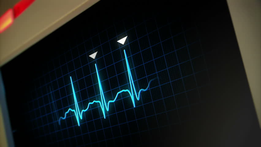 A hospital computer screen monitoring a human heart.  100% loopable