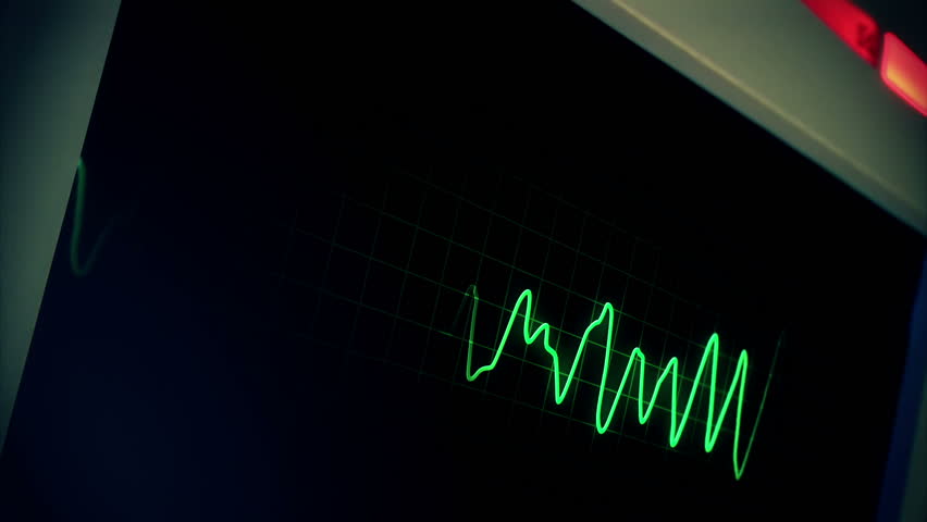 A hospital computer screen monitoring a human heart.  100% loopable