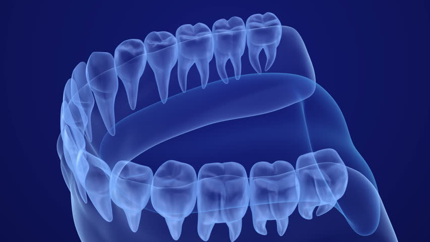 Mouth Gum And Teeth Xray Stock Footage Video 100 Royalty Free Shutterstock