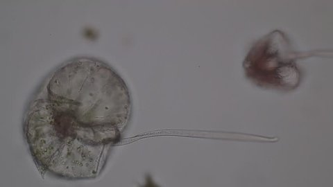 Noctiluca /Dinoflagellate (Marine Protozoa) under microscope.