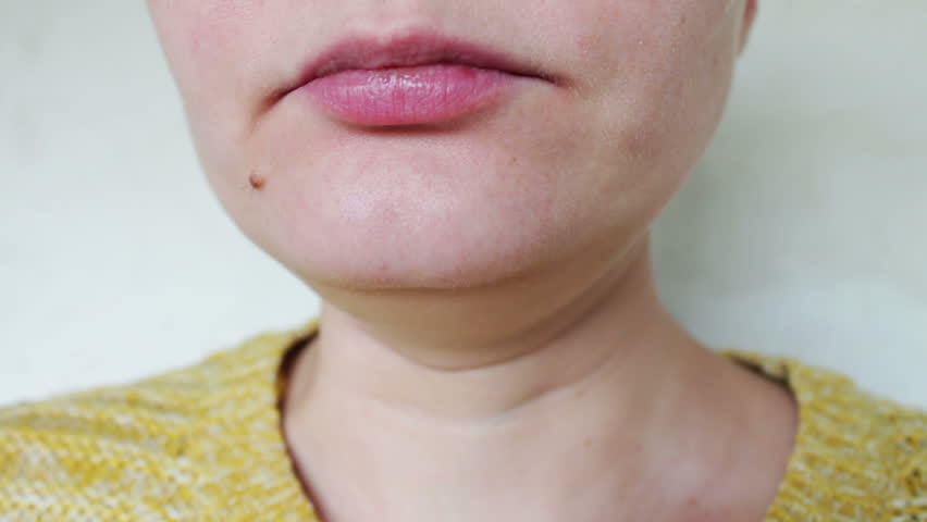 Girl shows yellow tongue